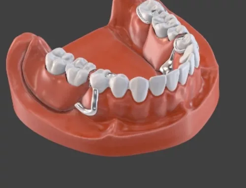 Jaw Configurator – Precision customization made easy